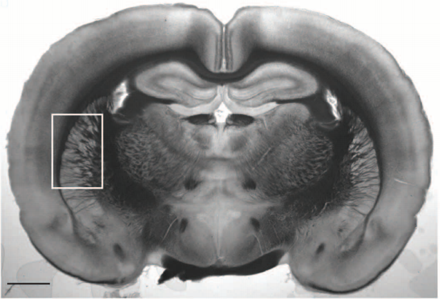 Corte coronal de cerebro de rata donde se puede ver