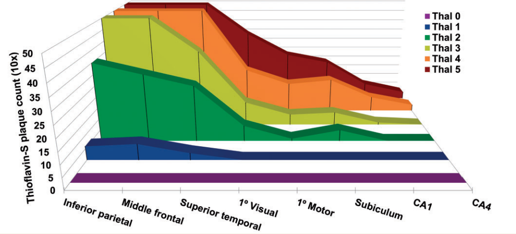 Progresión típica de la fisiopatología del Alzheimer según la escala de Thal (Fuente: Murray et al., 2015)